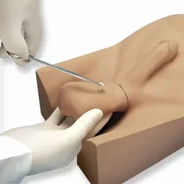 Is Vasectomy in Auckland Right for You? Key Benefits and Considerations